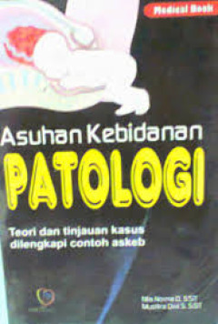 1 cover