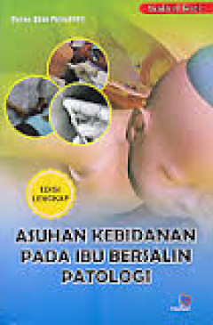 1 cover