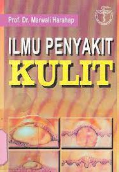 1 cover