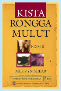 Image of Kista Rongga Mulut